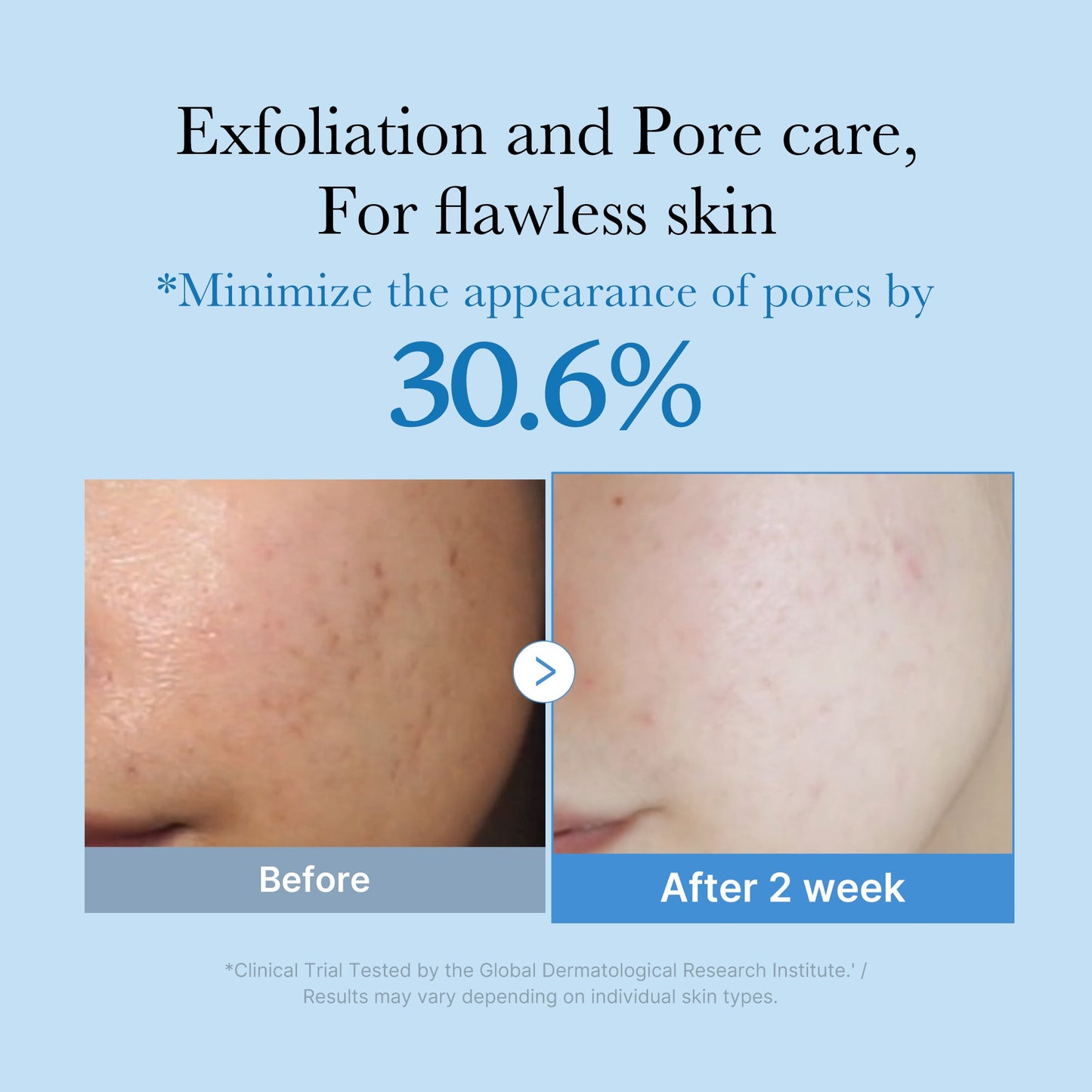 zero-pore-toner-y6 01_d6480b4e-3c08-4954-994a-ed5212c1839c.jpg