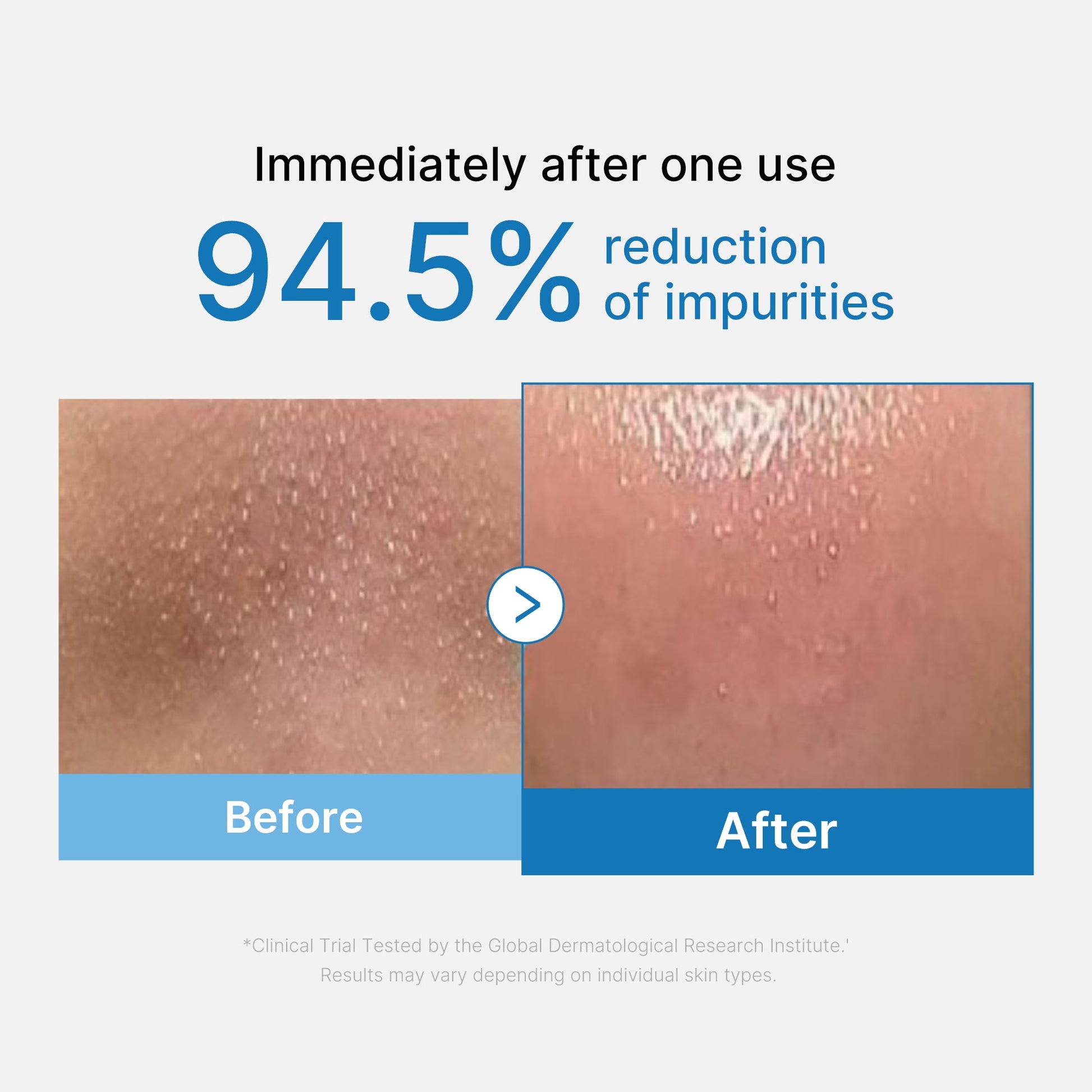 zero-pore-blackhead-deep-cleansing-oil-f6 01_eed557ec-5857-46a2-8b17-dbd67c692dcb.jpg