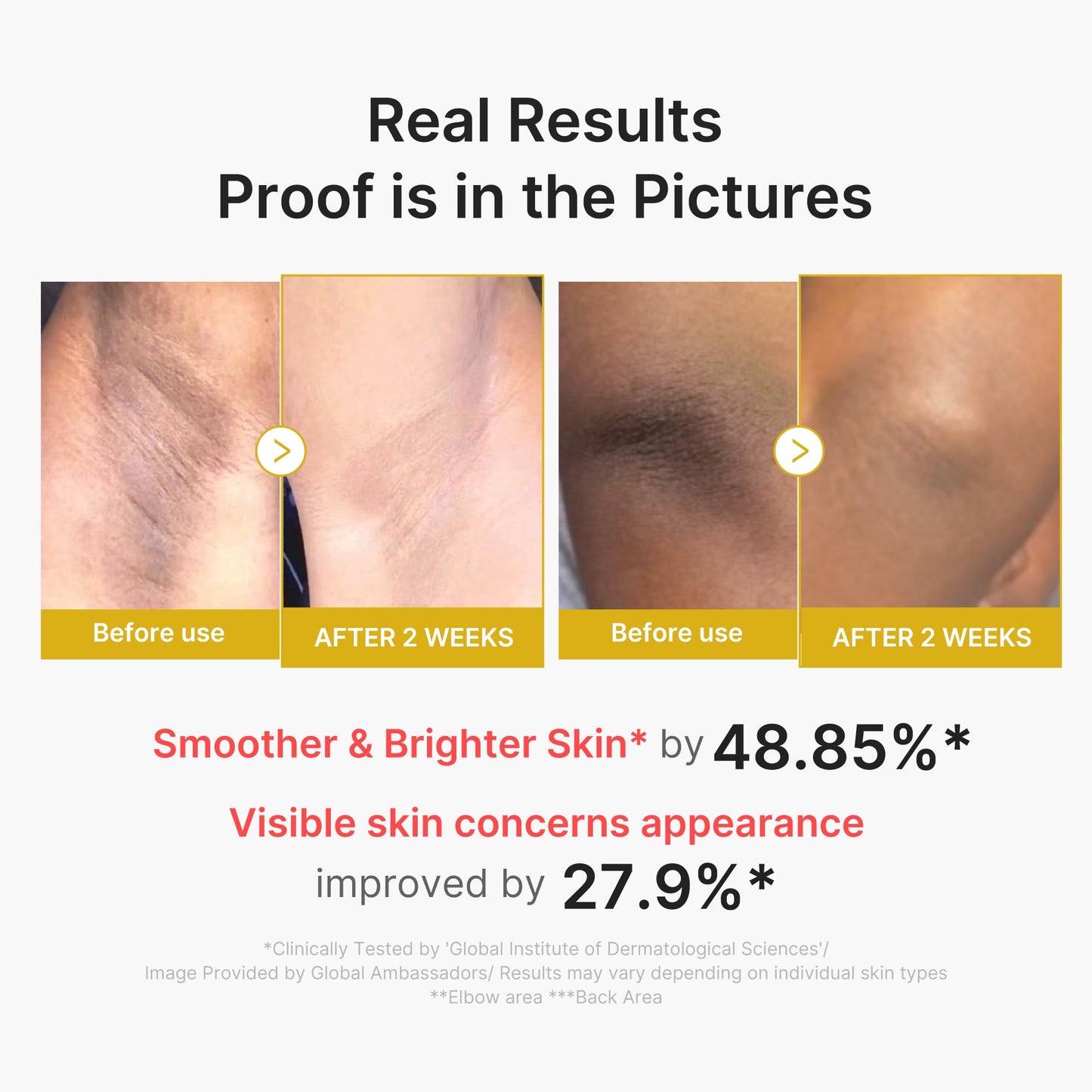 kojic-acid-turmeric-body-peel-shot-q2 02_72880cfc-382b-440b-8152-7e3dce87da2a.jpg