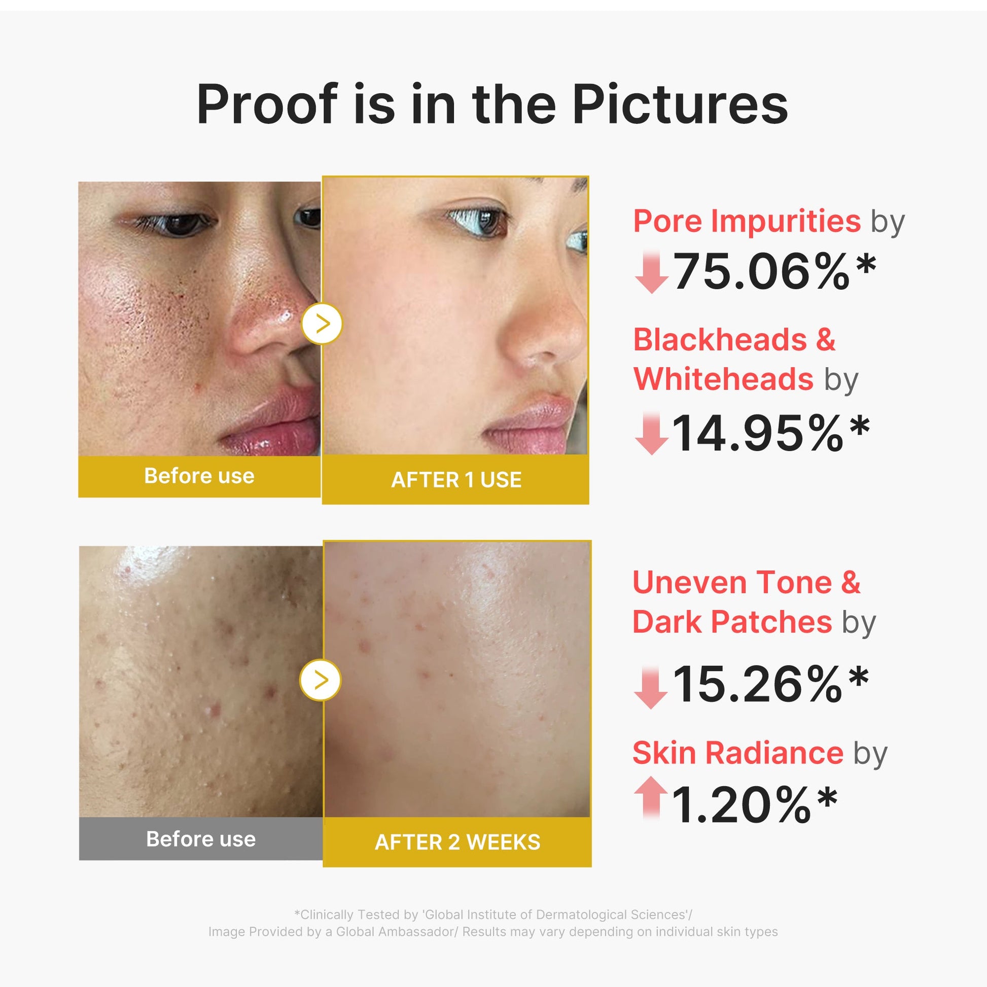 kojic-acid-turmeric-peel-shot-n0 02_45fe66d3-b3f6-4100-aa52-2afd7eded417.jpg