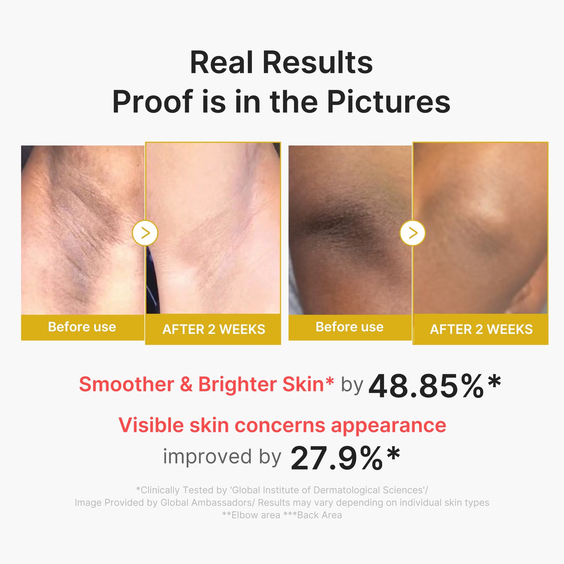 kojic-acid-turmeric-body-peel-shot-q8 02_72880cfc-382b-440b-8152-7e3dce87da2a.jpg