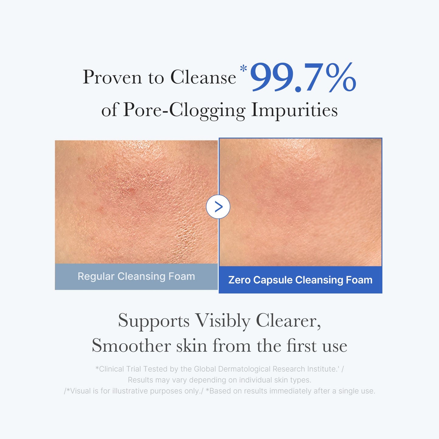 zero-pore-capsule-cleansing-foam-o6 02_c1fb9dfb-86c5-4038-8ff8-490d1006276c.jpg
