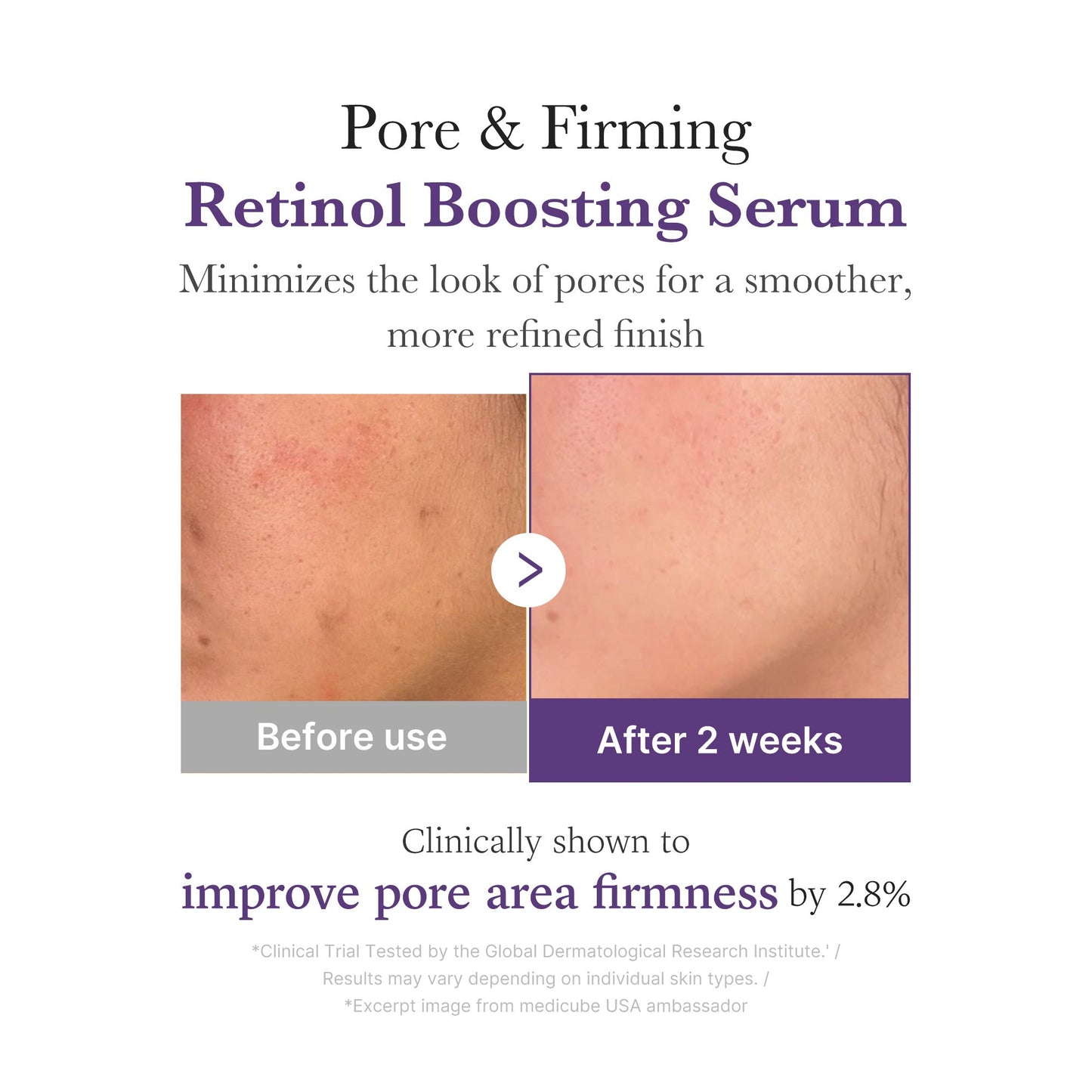 retinol-nmn-boosting-serum-o2 03_3510e7a5-5633-4a18-81ea-1389593bd517.jpg