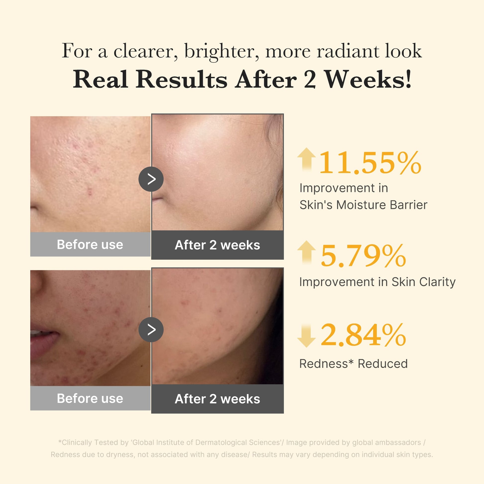 kojic-acid-turmeric-capsule-serum-q9 03_436487f5-76df-490e-8a61-01118373efbd.jpg