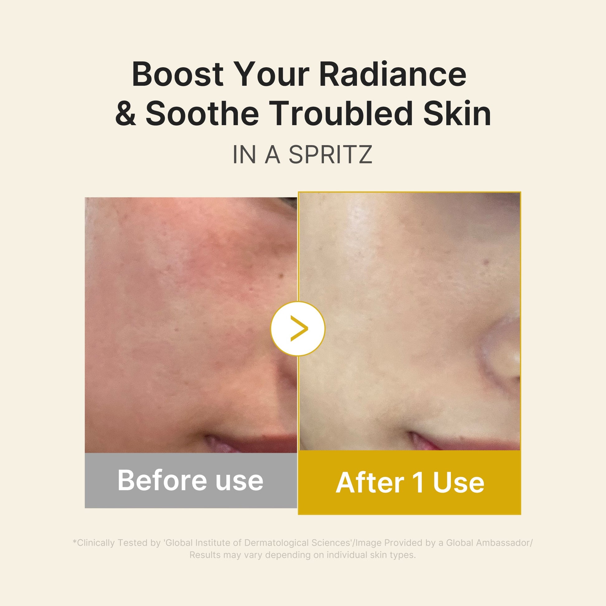kojic-acid-turmeric-vitamin-gold-jelly-mist-serum-j7 03_dc9cd19e-4e57-49d3-9b66-c7762e8a63f1.jpg