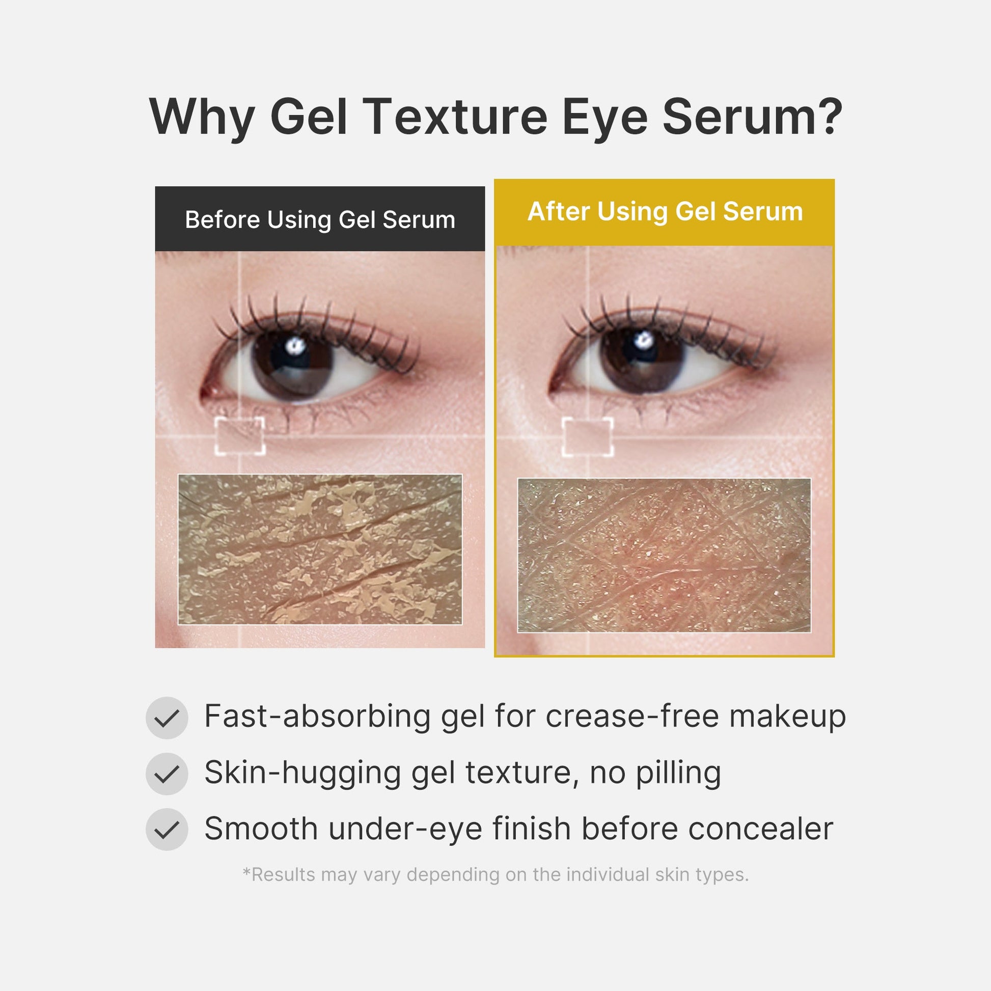 kojic-acid-tumeric-eye-gel-serum-c8 04_0487ef36-49f4-4294-8049-bb55118b05fe.jpg