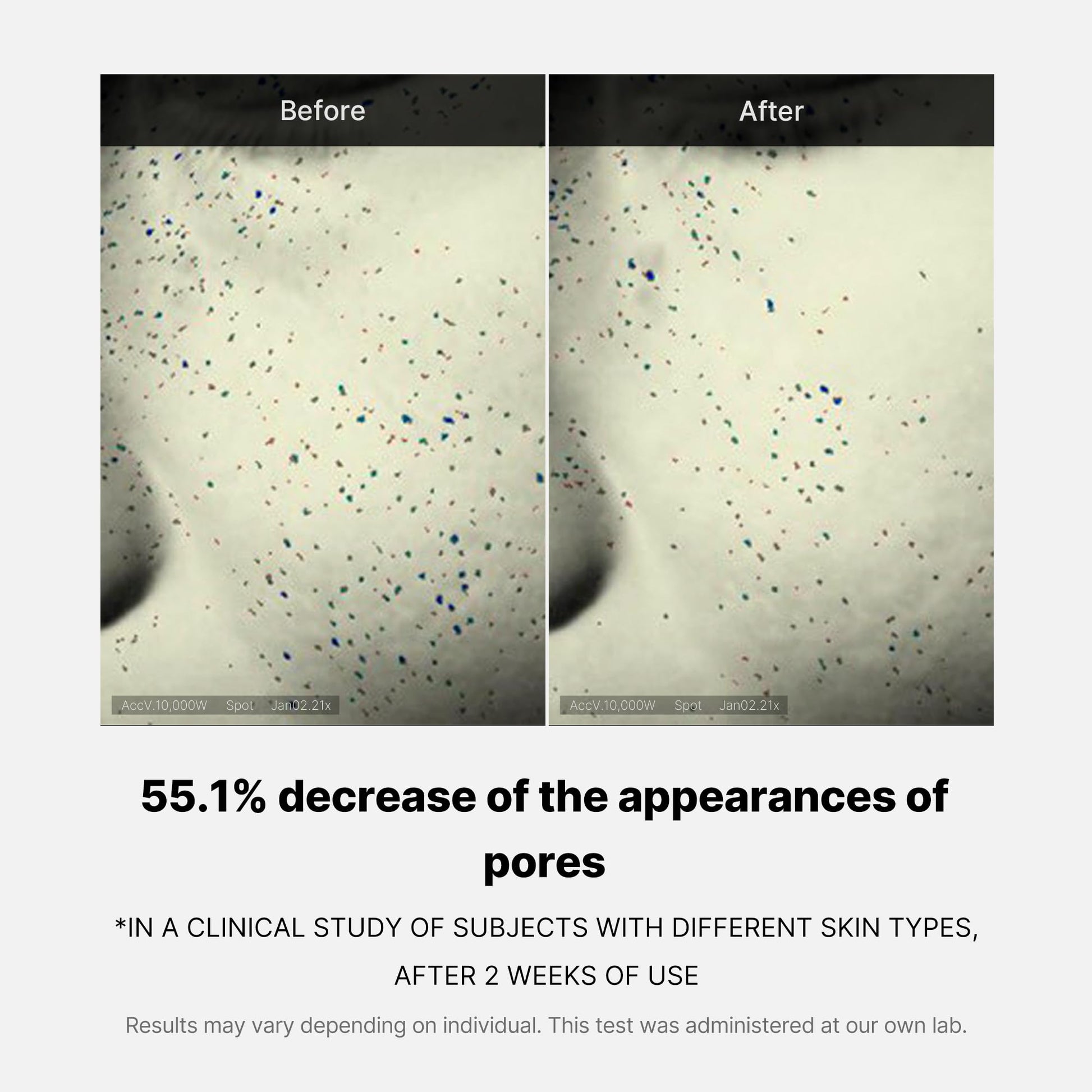 zero-pore-one-day-cream-x1 04_3616addc-f184-4deb-a5d7-e3a782e4713d.jpg