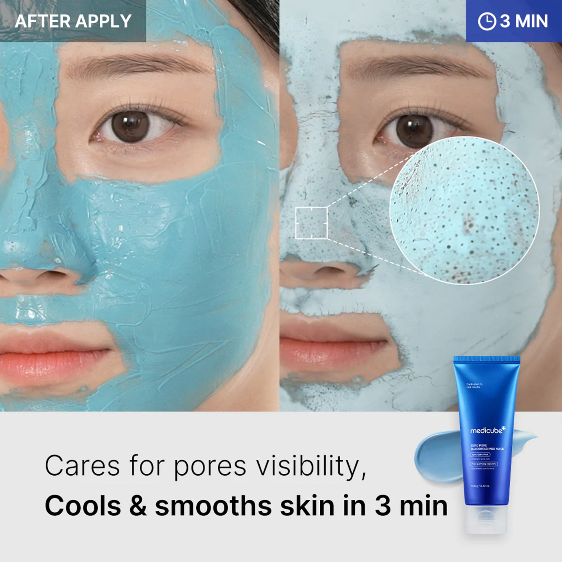 zero-pore-blackhead-mud-mask-b9 04_867c0459-a94e-40d3-bd9a-70400edabe8d.jpg