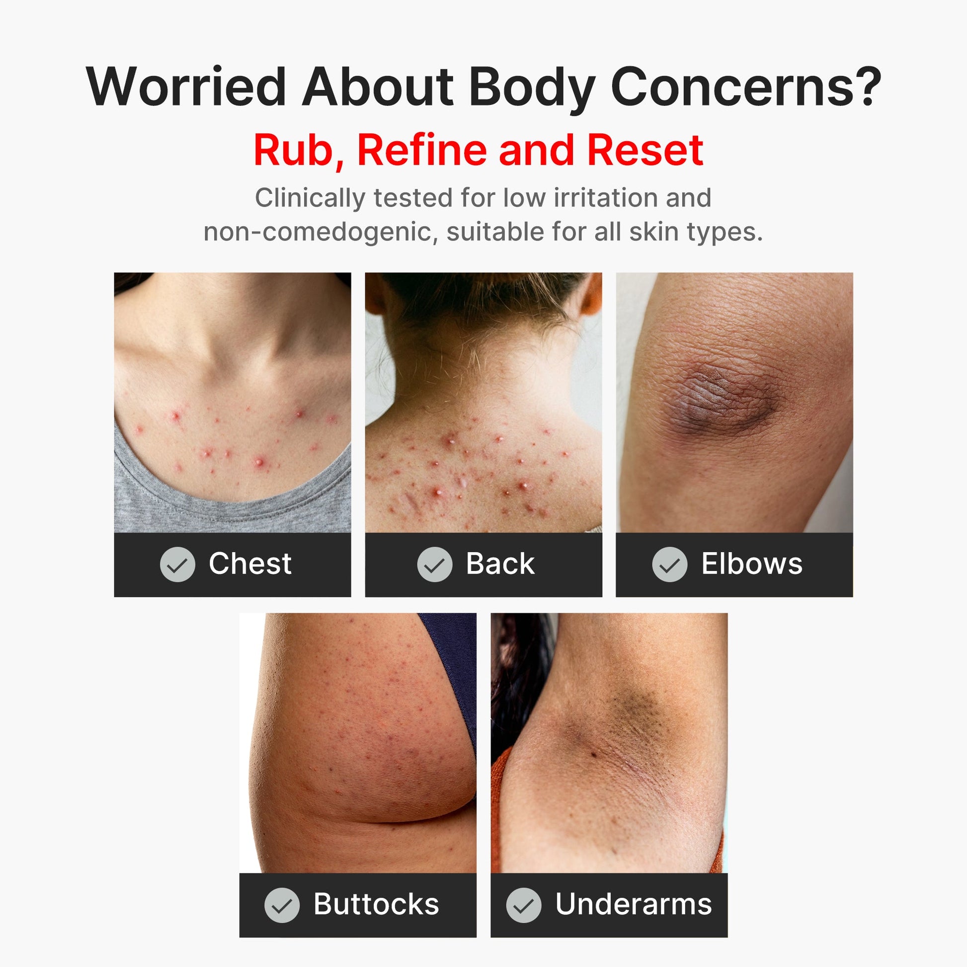 kojic-acid-turmeric-body-peel-shot-q8 04_8a7237f2-3ebf-401e-bd85-54841aeb3efc.jpg