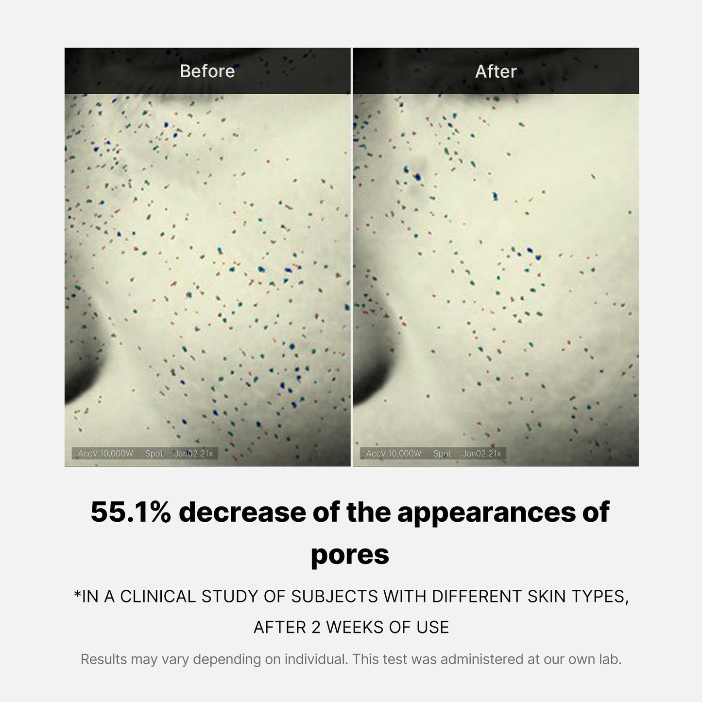 pore-care-duo-a5 05_12ddab8a-64be-4612-8ee1-27e5ec701921.jpg
