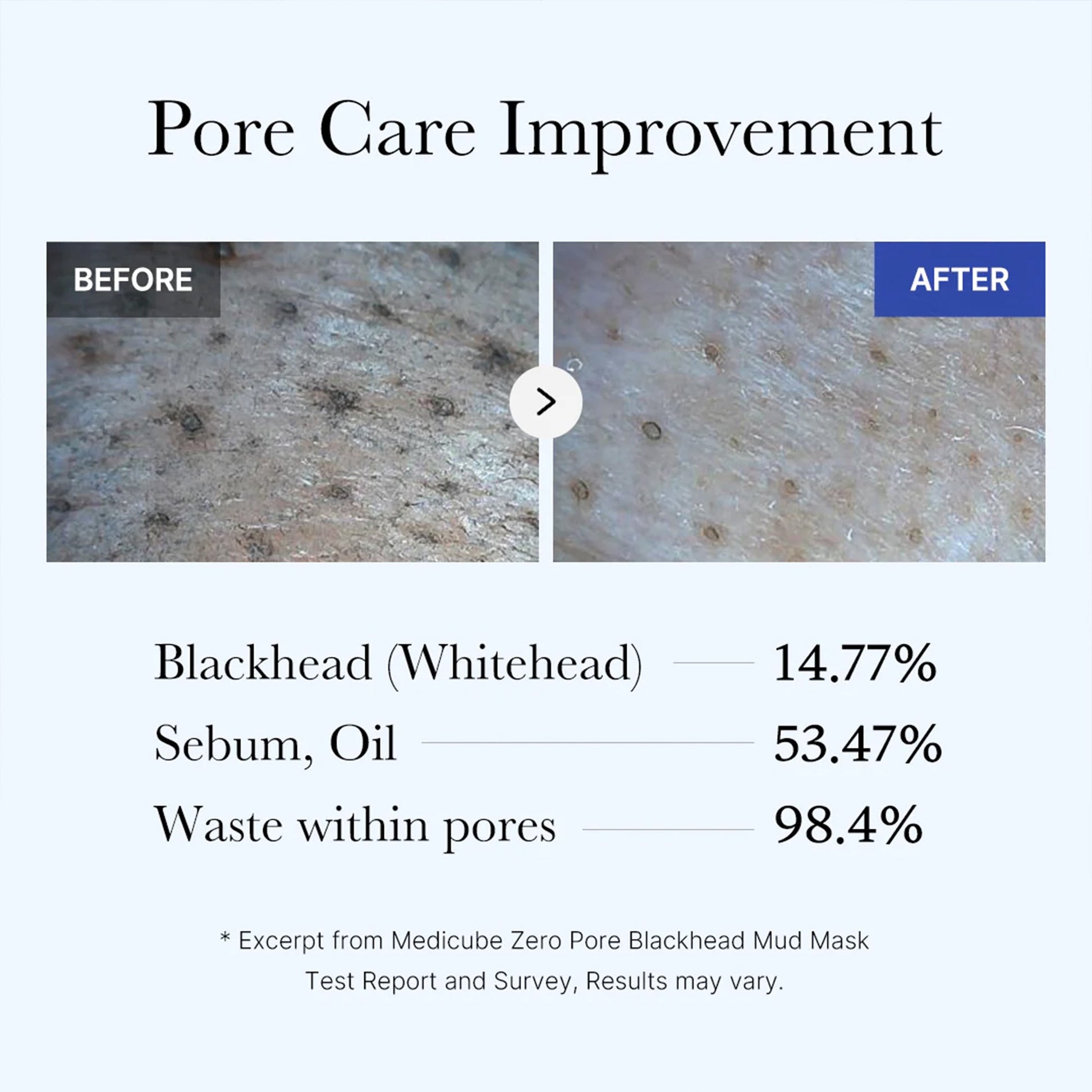 zero-pore-blackhead-mud-mask-b9 05_9362a158-c2b3-4525-acc0-631a2cfdea47.jpg
