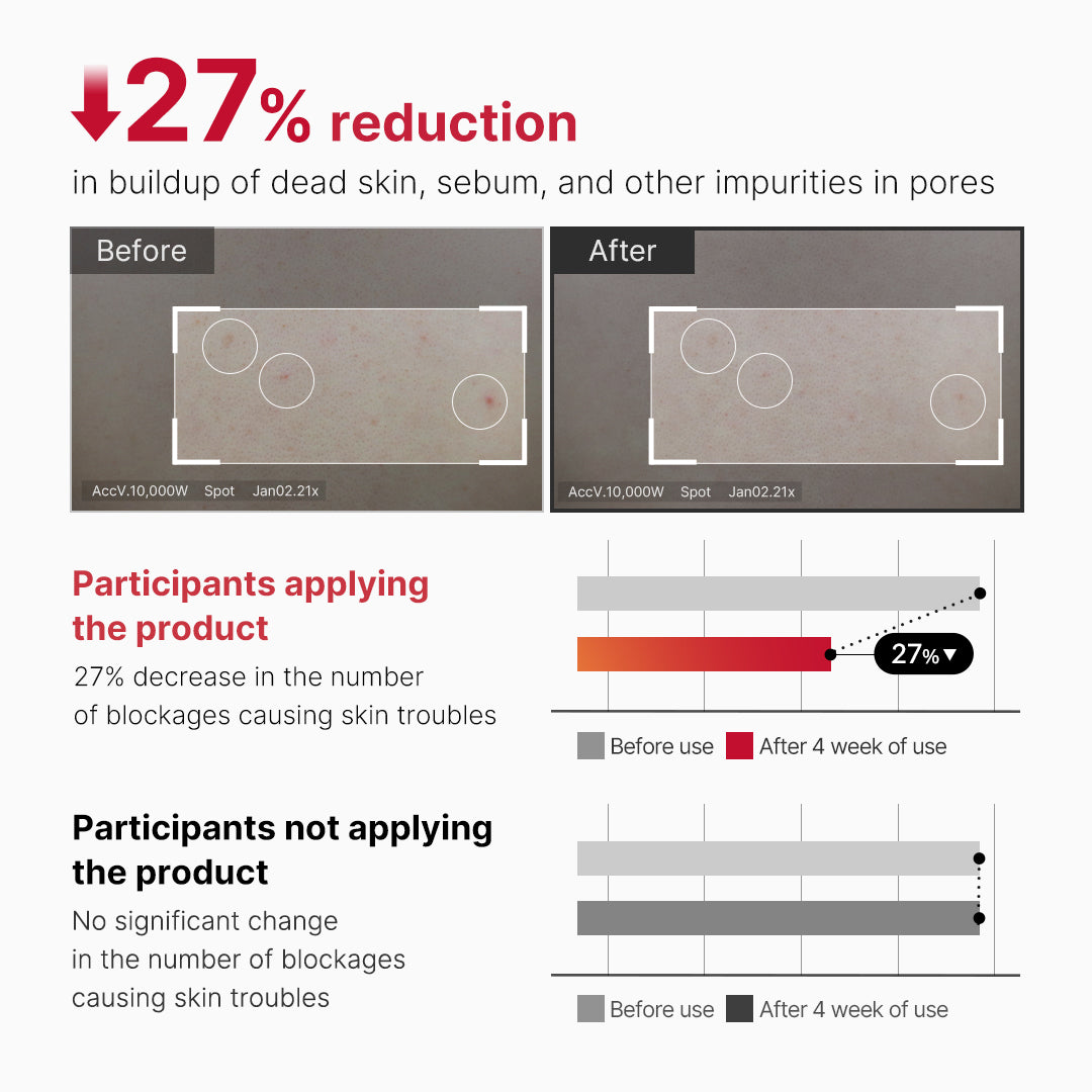 red-body-peeling-shot-cleanser-l8 07_60b5b2fd-b0f0-4cae-b358-5c38181e8dd8.jpg