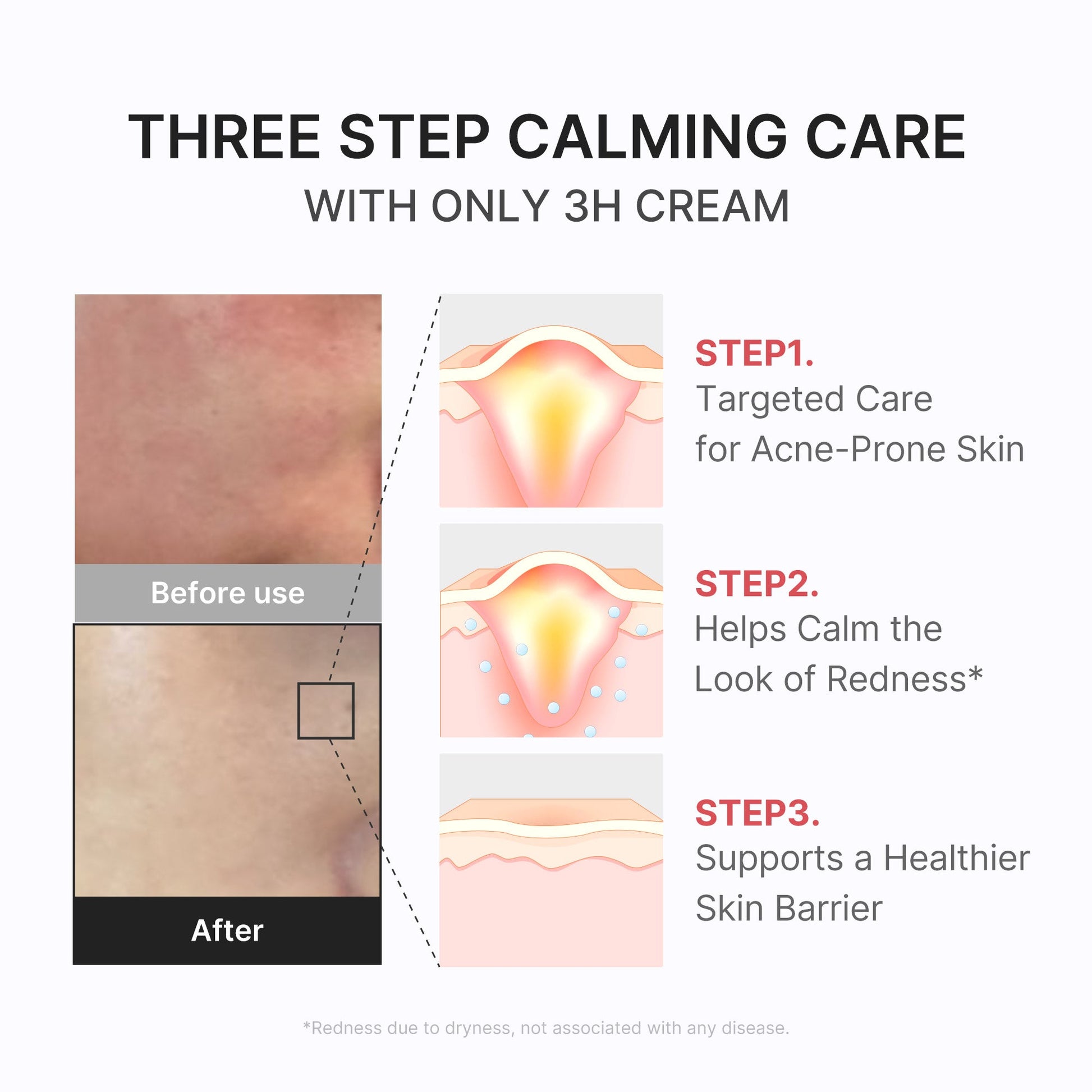 3h-daily-relief-cream-z0 3H_04.jpg