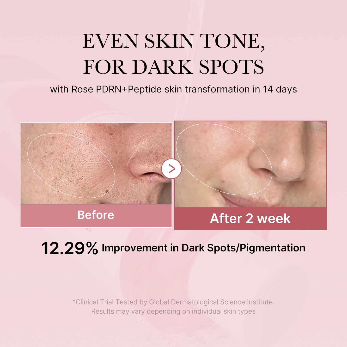 pdrn-pink-peptide-toner-k5 PDRN_01_308c518e-5ac6-4e54-99bd-eabc8796739b.jpg