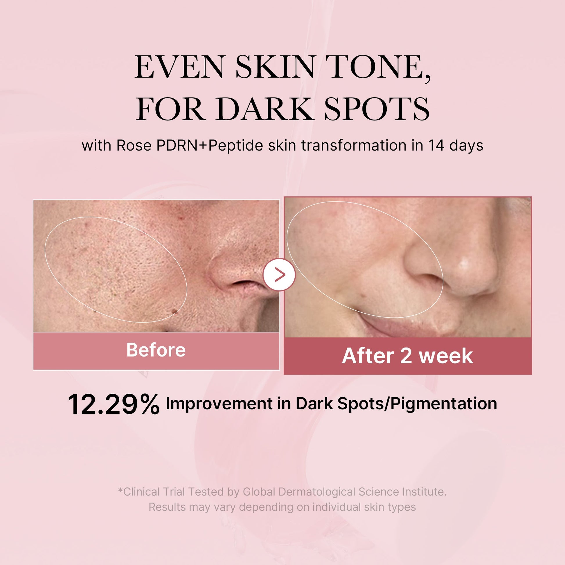 pdrn-pink-peptide-toner-k5 PDRN_01_308c518e-5ac6-4e54-99bd-eabc8796739b.jpg