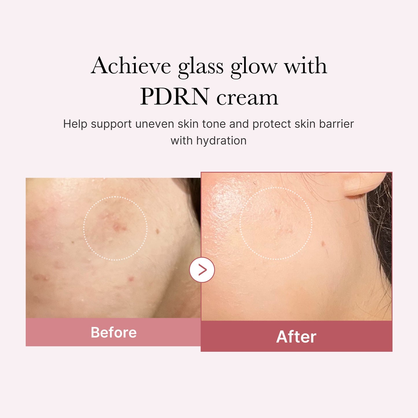 pdrn-pink-peptide-cream-o9 PDRN_02_d7805bfe-cf43-446a-b71b-a276683f136b.jpg