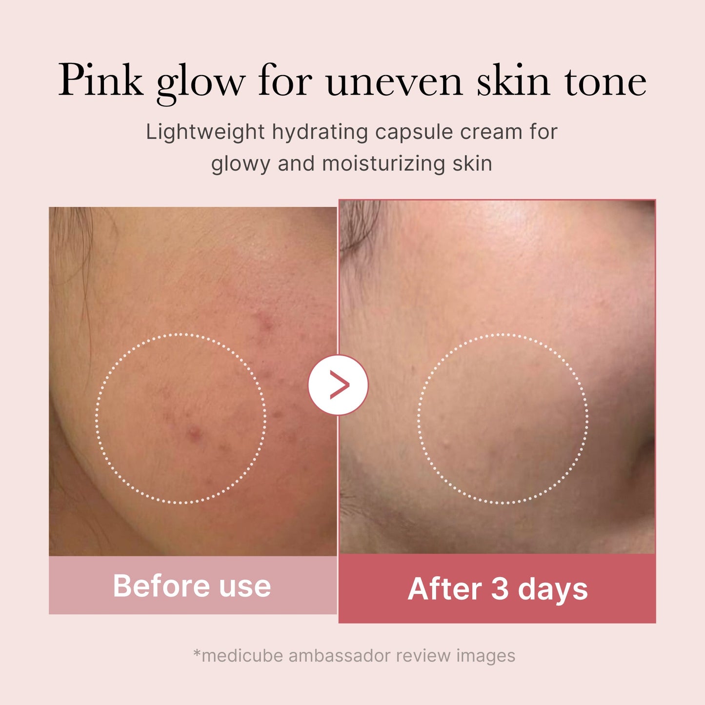 pdrn-pink-collagen-capsule-cream-u3 PDRN_03_058d09d8-4f44-4b1e-927c-e27b1738ae51.jpg