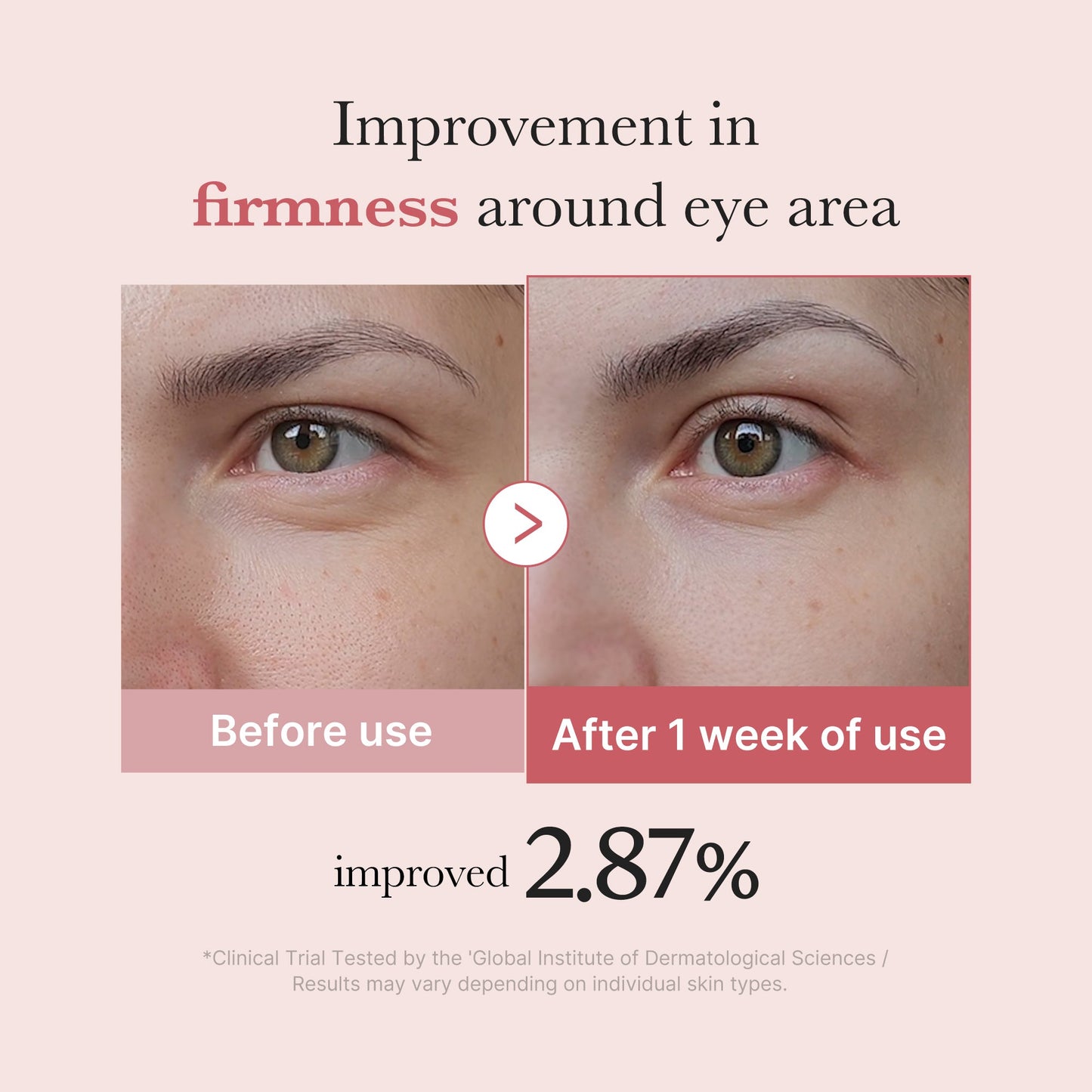 pdrn-pink-peptide-eye-cream-n5 PDRN_03_256dd753-0a2f-41b4-b3cd-bbfd3bc27018.jpg