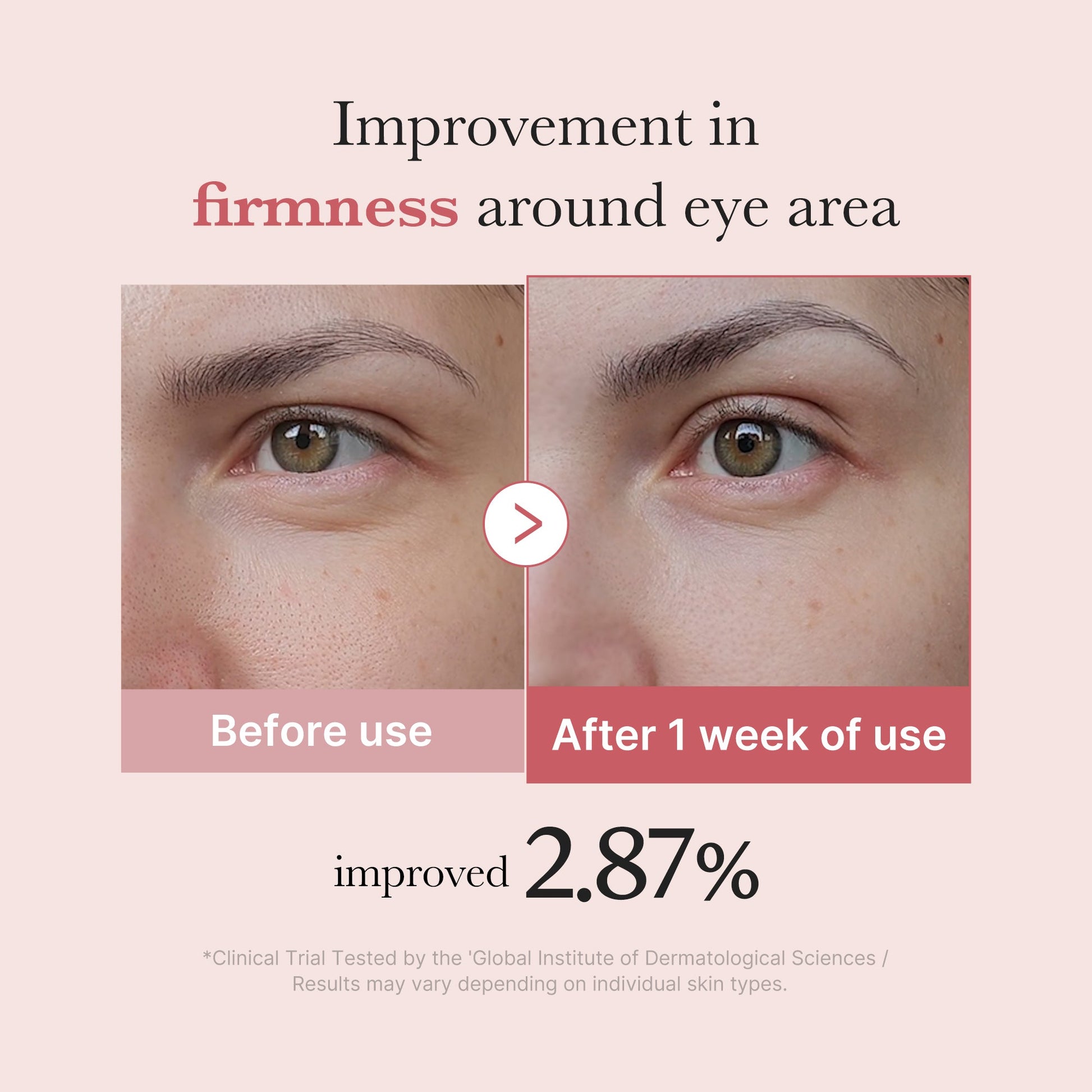 pdrn-pink-peptide-eye-cream-n5 PDRN_03_256dd753-0a2f-41b4-b3cd-bbfd3bc27018.jpg