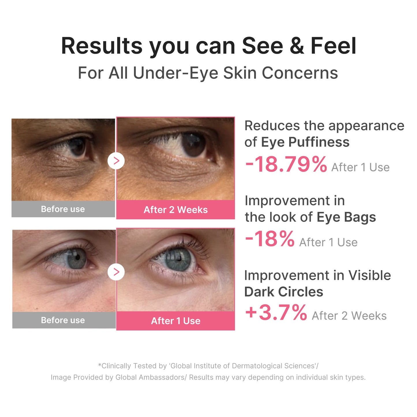 pdrn-caffeine-collagen-eye-patch-t8 PDRN_03_cdce2143-b8d8-43cb-ac69-fcbdf6640249.jpg