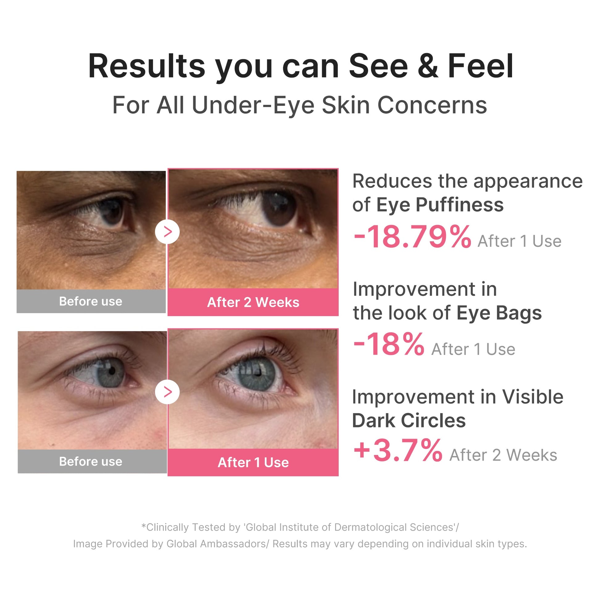 pdrn-caffeine-collagen-eye-patch-t8 PDRN_03_cdce2143-b8d8-43cb-ac69-fcbdf6640249.jpg