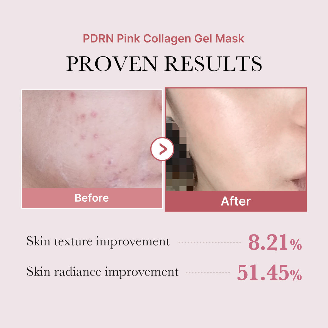 salmon-pdrn-pink-collagen-jelly-gel-mask-c6 PDRN_12.jpg