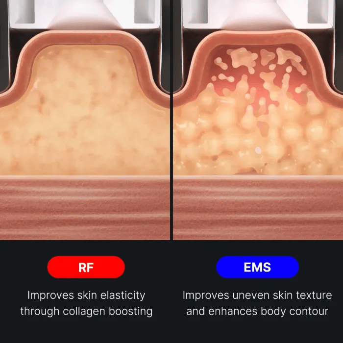 age-r-contour-body-shot-r7 img.webp